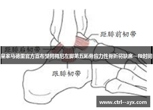 皇家马德里官方宣布楚阿梅尼左脚第五跖骨应力性骨折将缺席一段时间